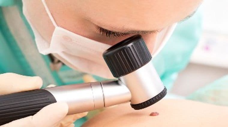 A clinician examining a skin growth using dermatoscope